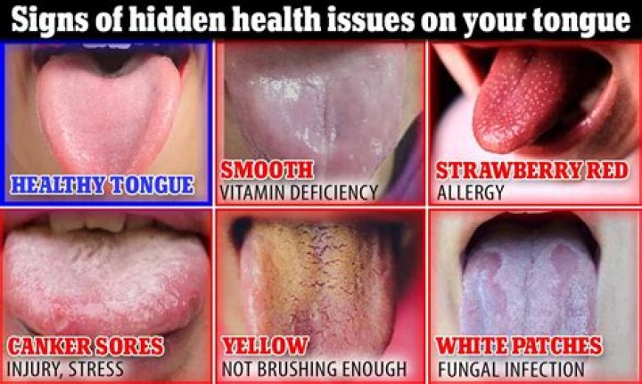 What causes your tongue to stop working?
